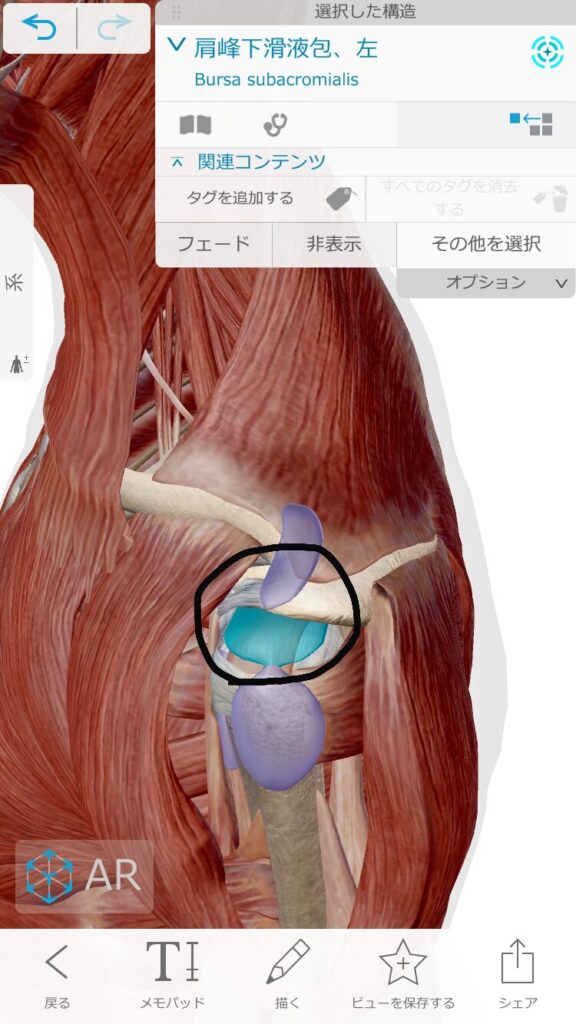 肩峰下滑液包炎