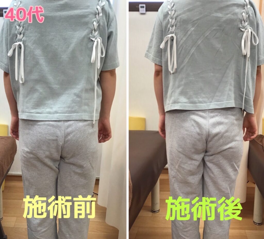 ビフォーアフター写真