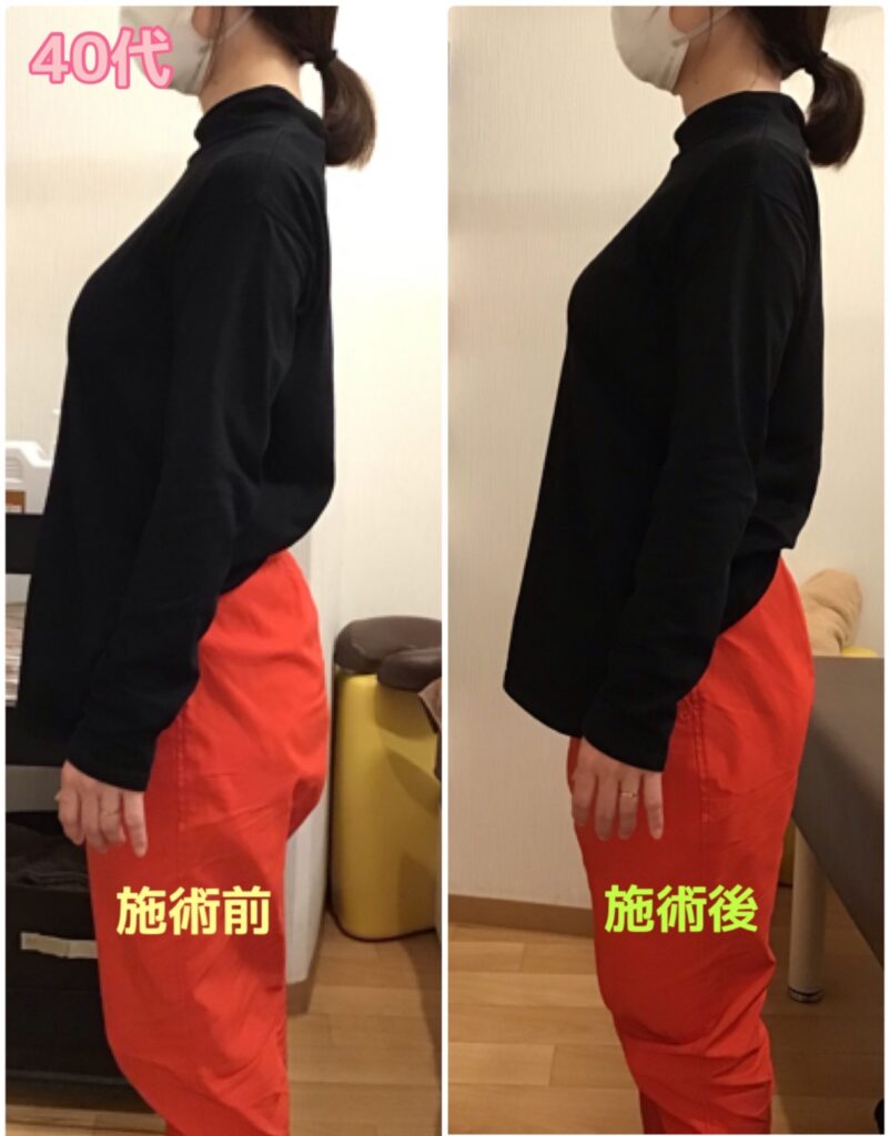 ビフォーアフター写真