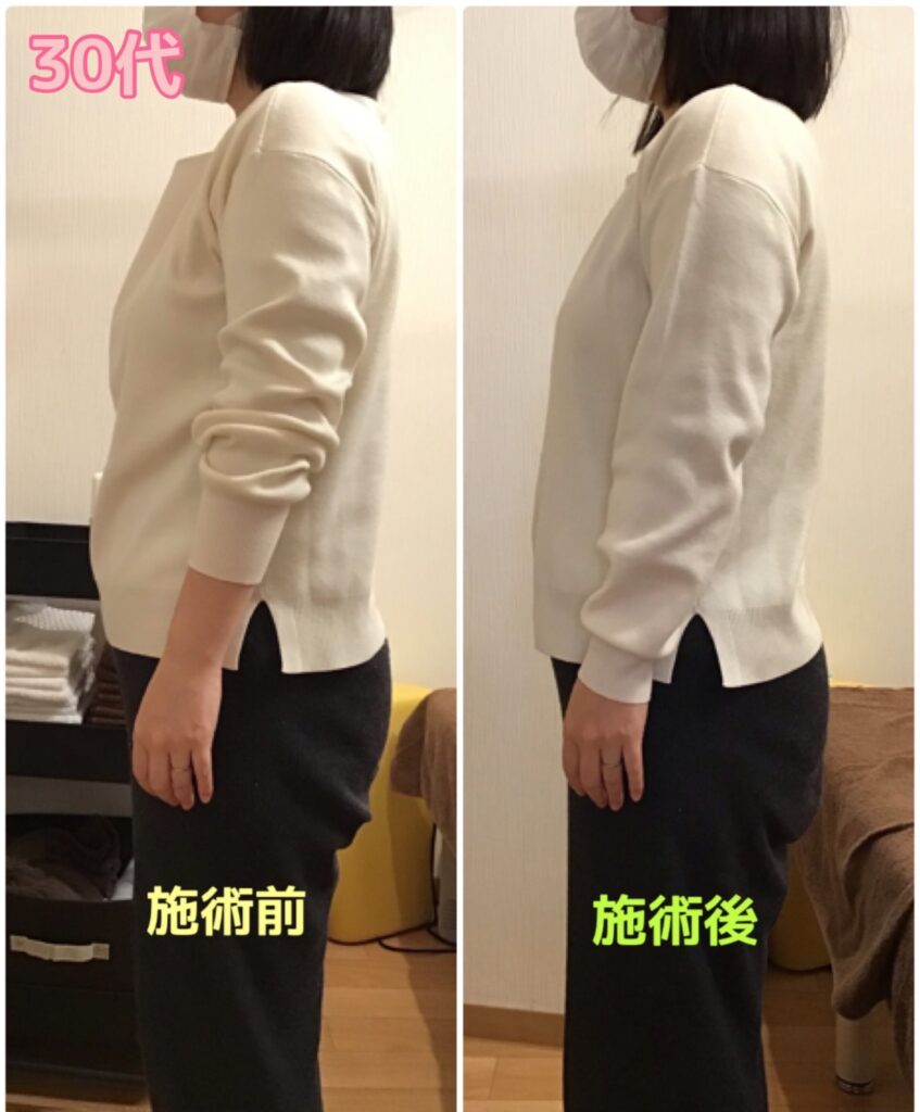 ビフォーアフター写真