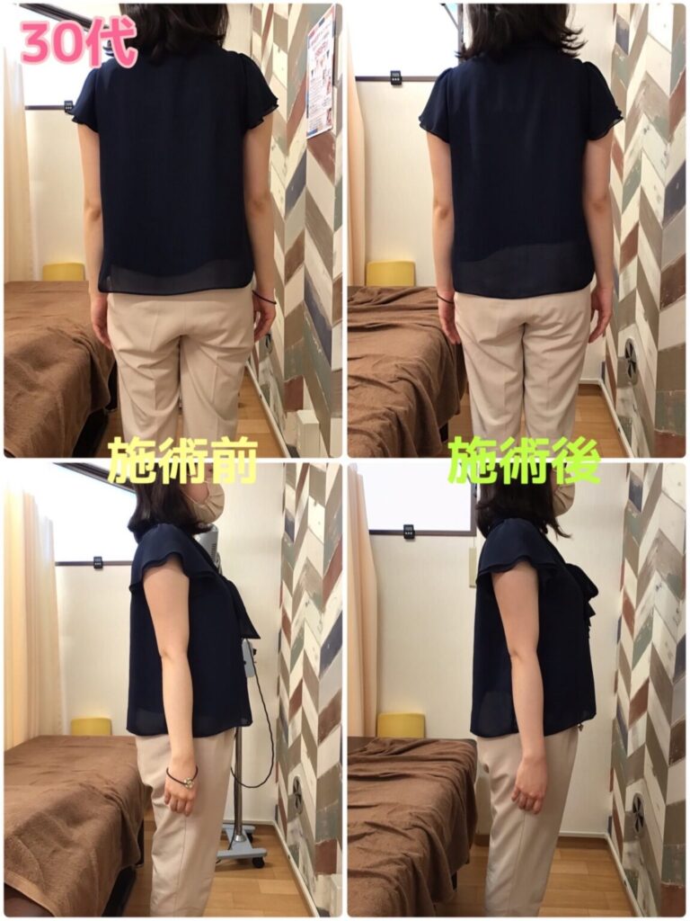 ビフォーアフター写真