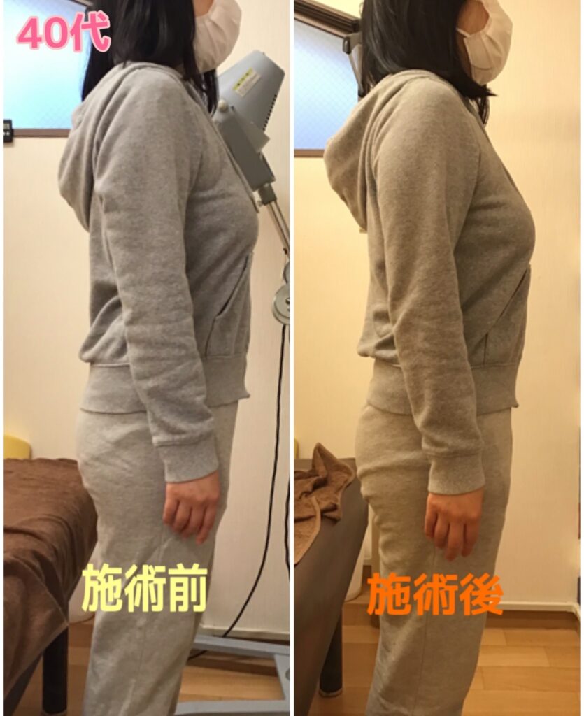 ビフォーアフター写真