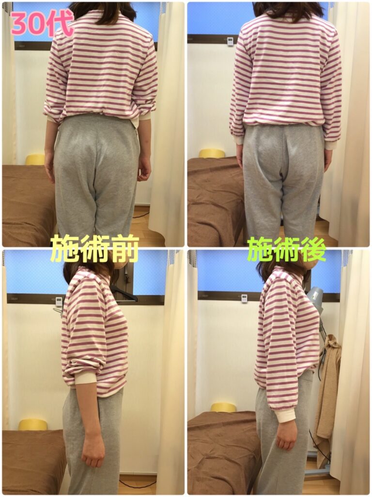 ビフォーアフター写真