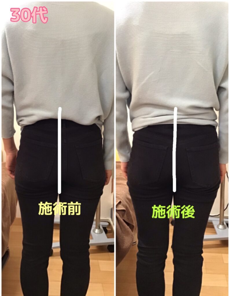 ビフォーアフター写真