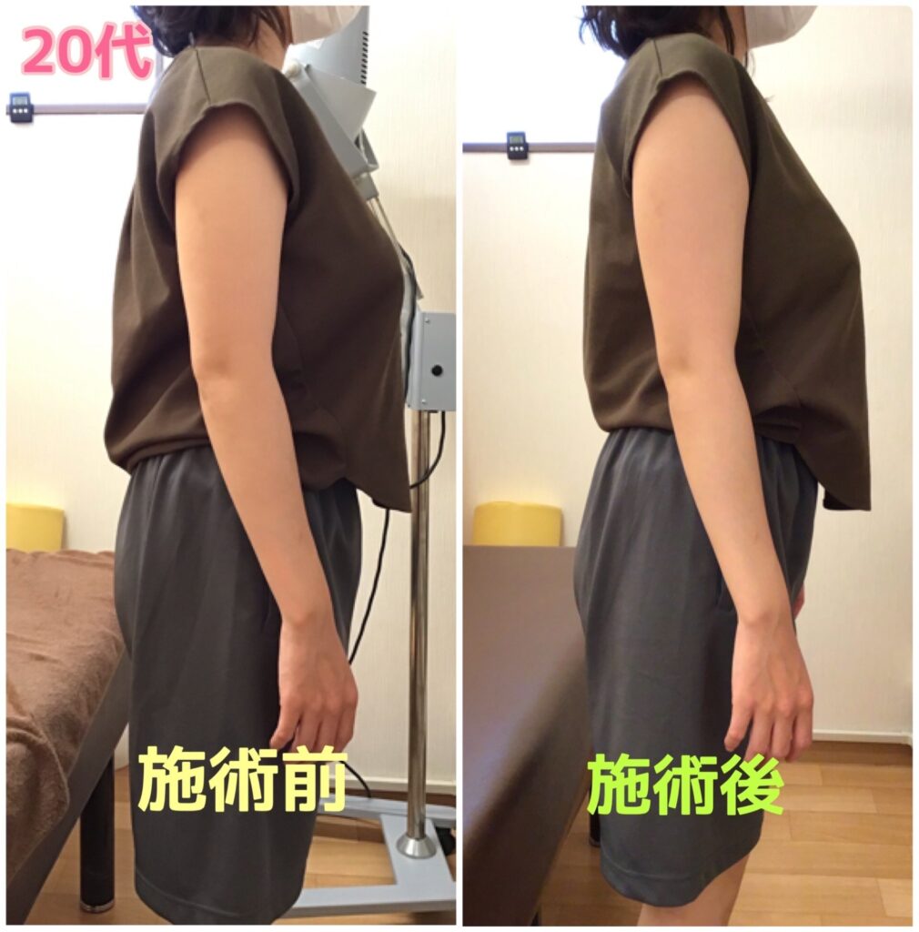 ビフォーアフター写真