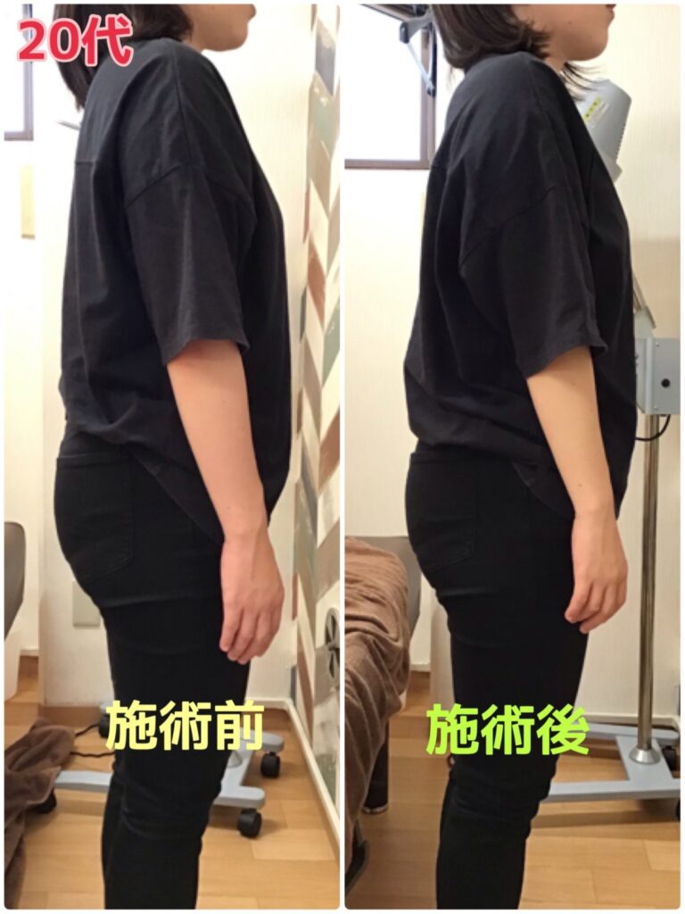 ビフォーアフター写真