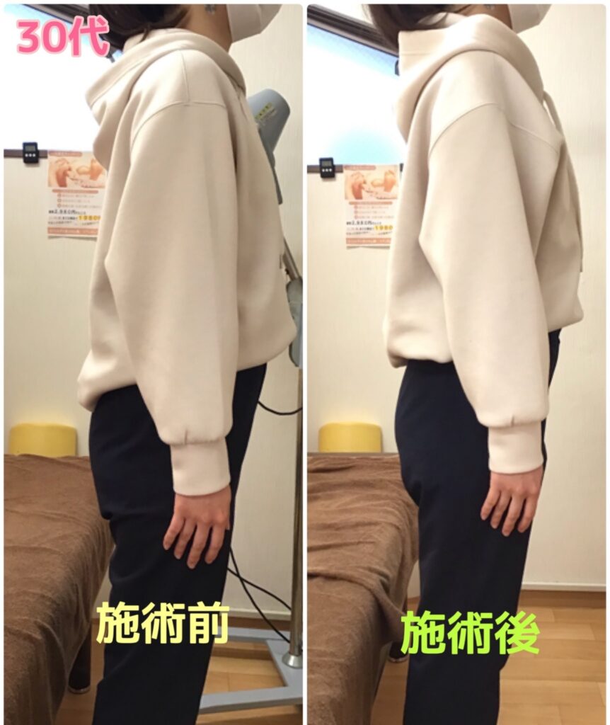 ビフォーアフター写真