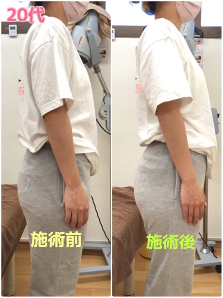 ビフォーアフター写真