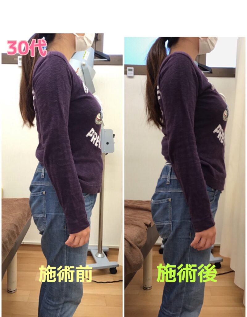 ビフォーアフター写真