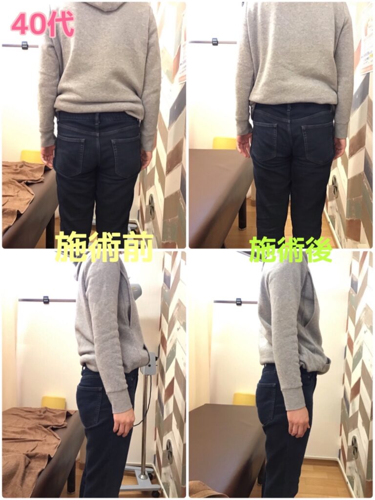 ビフォーアフター写真