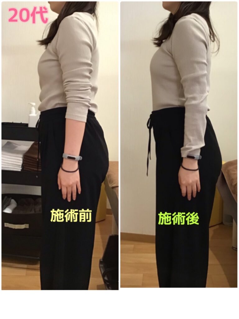 ビフォーアフター写真