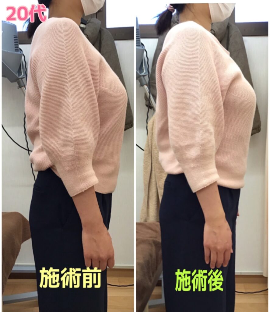 ビフォーアフター写真