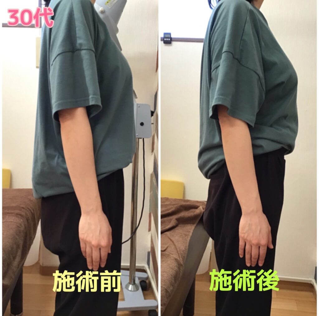 ビフォーアフター写真