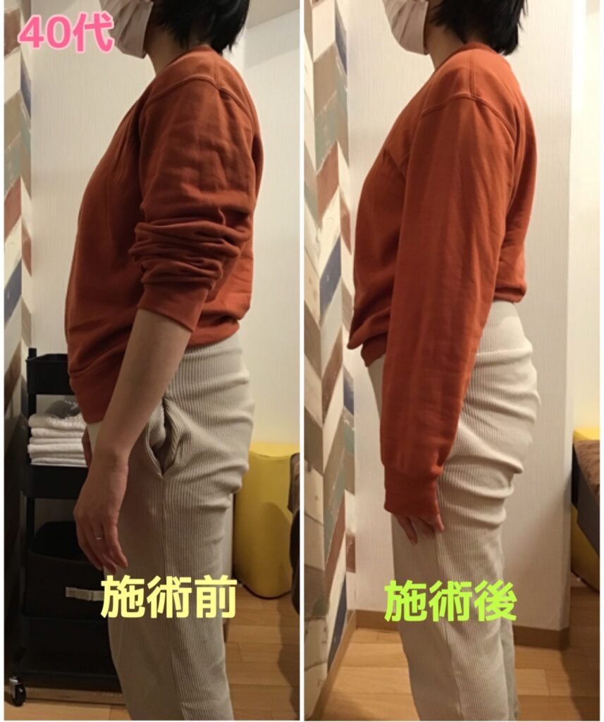 ビフォーアフター写真