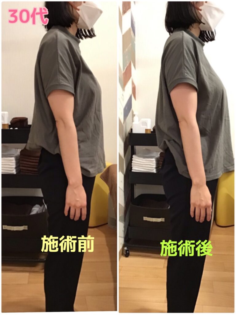 ビフォーアフター写真