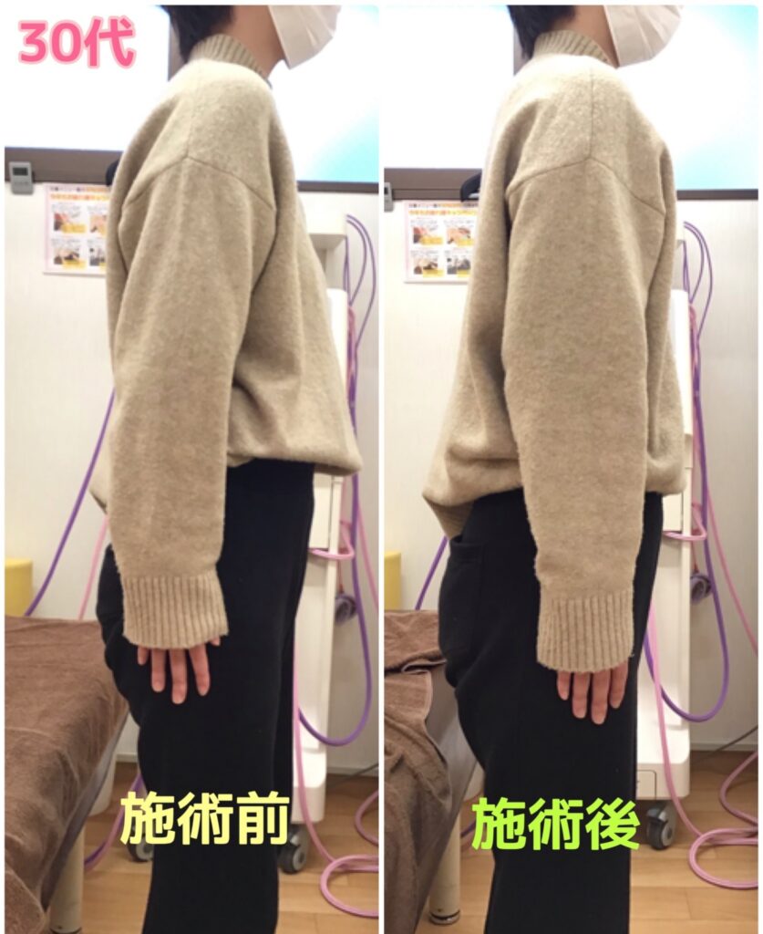 ビフォーアフター写真