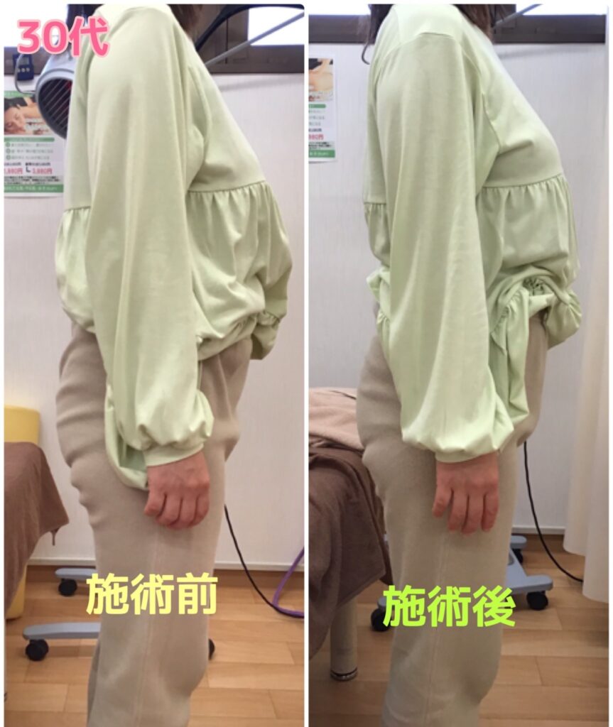 ビフォーアフター写真