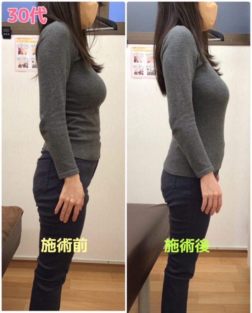 ビフォーアフター写真