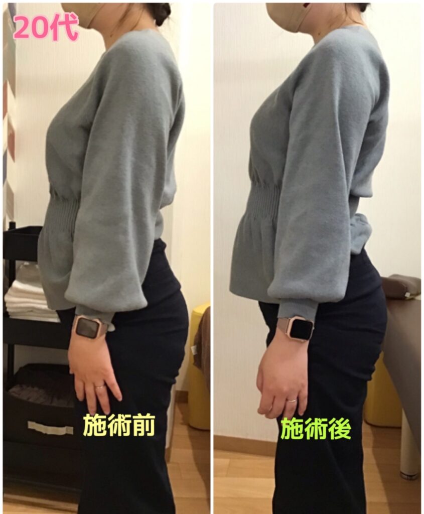 ビフォーアフター写真